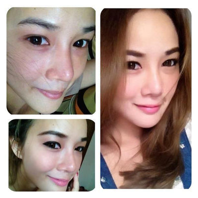 Anti-acne and anti-aging face cream set