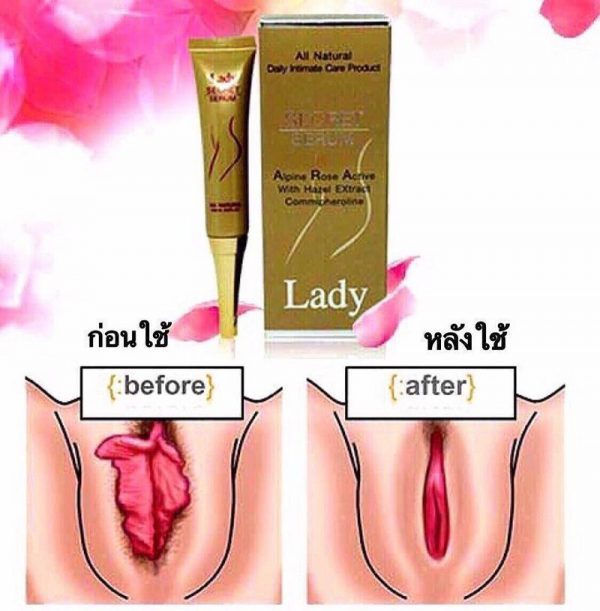 Lady Secret Serum All Natural No Lubricant/ Vagina Loose/ Odor dryness women
