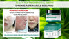 Complete Korean acne treatment system