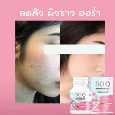 SOQ beauty supplement Thailand