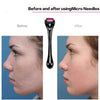 Titanium Needle Derma Roller for Skin Rejuvenation
