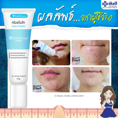 Acne-fighting formula developed by Yanhee Hospital