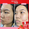 Froza Tomato Collagen supplement before and after